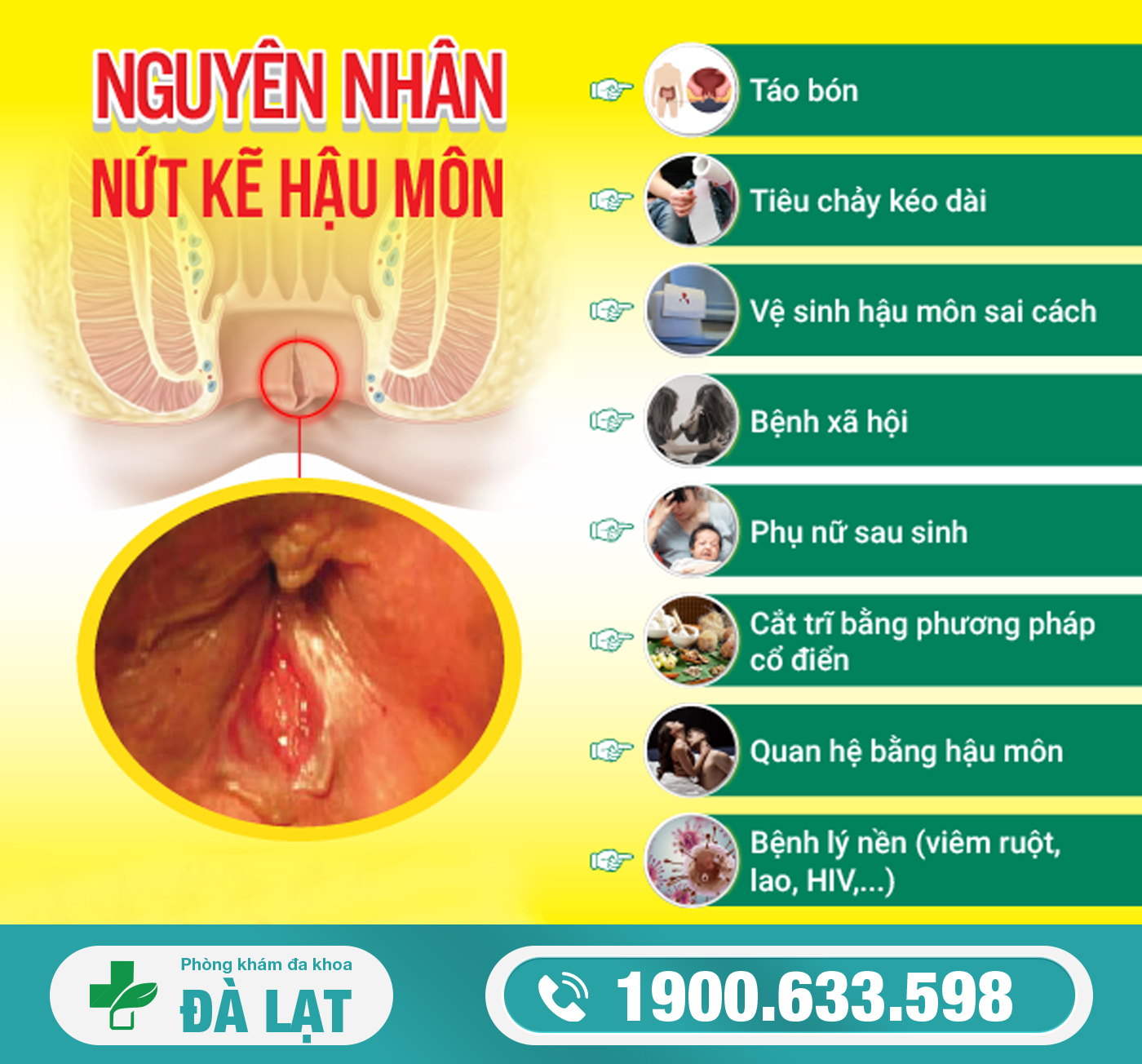Hình ảnh minh họa